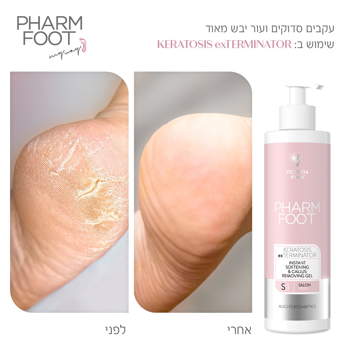 ג'ל להסרת קאלוס ויבלות - Pharm Foot | 300 ml | KERATOSIS exTERMINATOR photo number 1