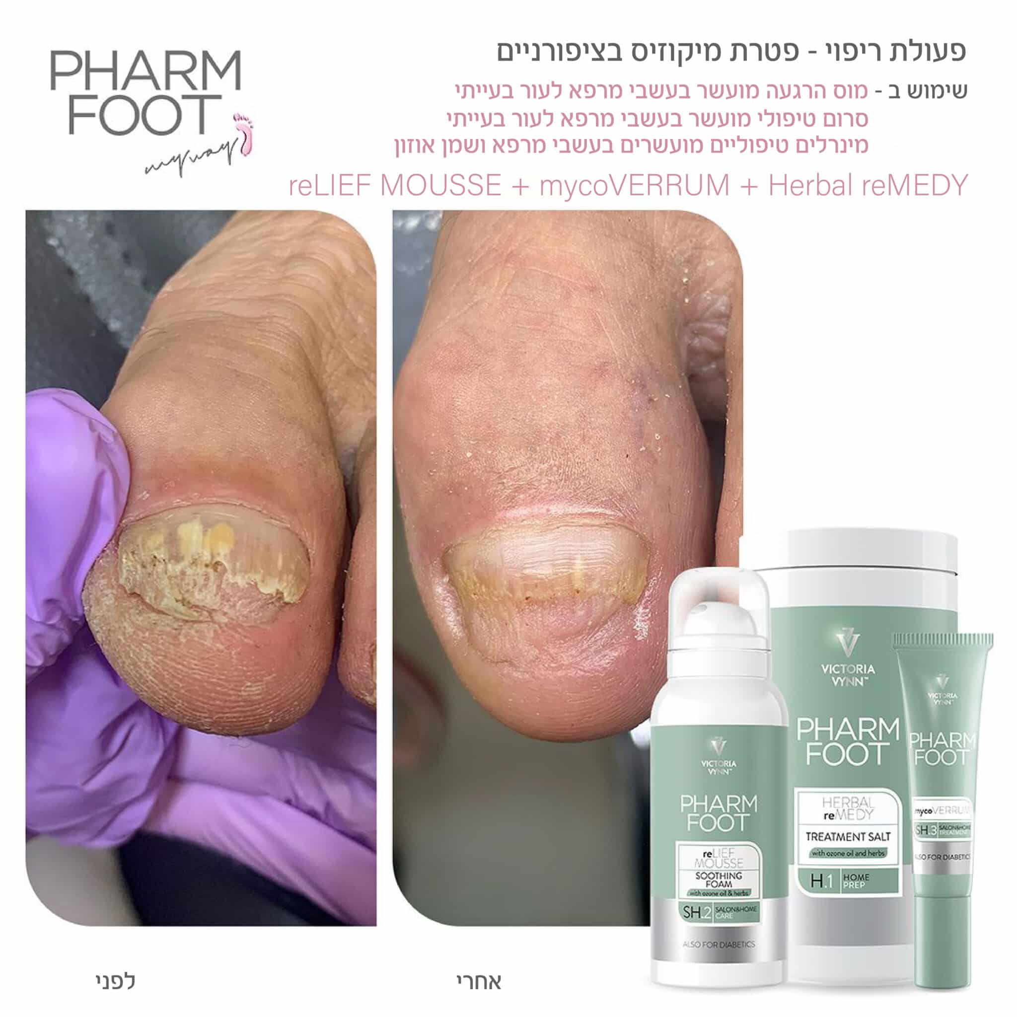 מינרלים טיפוליים מועשרים בעשבי מרפא ושמן אוזון - Herbal reMEDY | גר' 1250 | Pharm Foot photo number 1