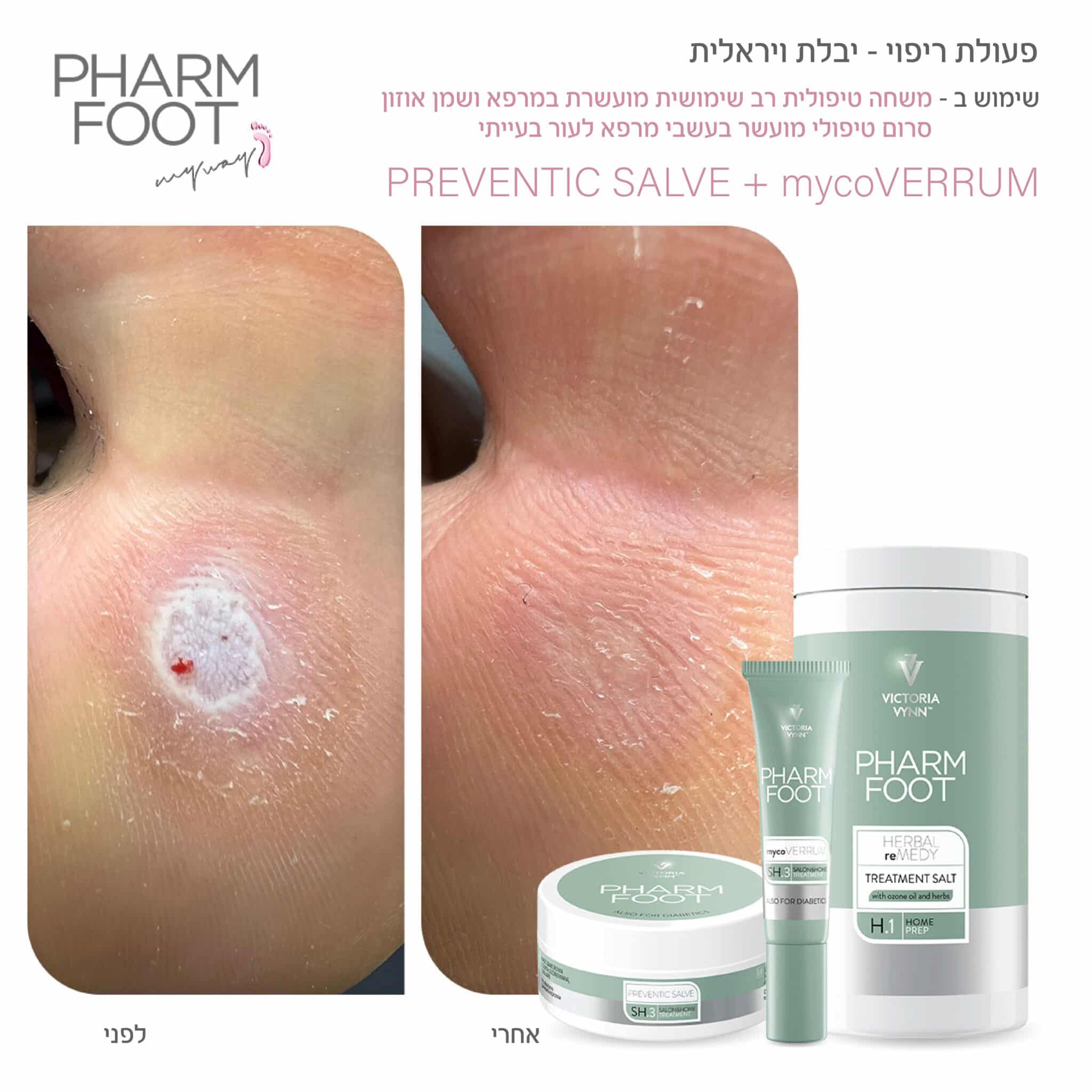 סרום טיפולי מועשר בעשבי מרפא לעור בעייתי - Pharm Foot | 15 ml | mycoVERRUM photo number 1